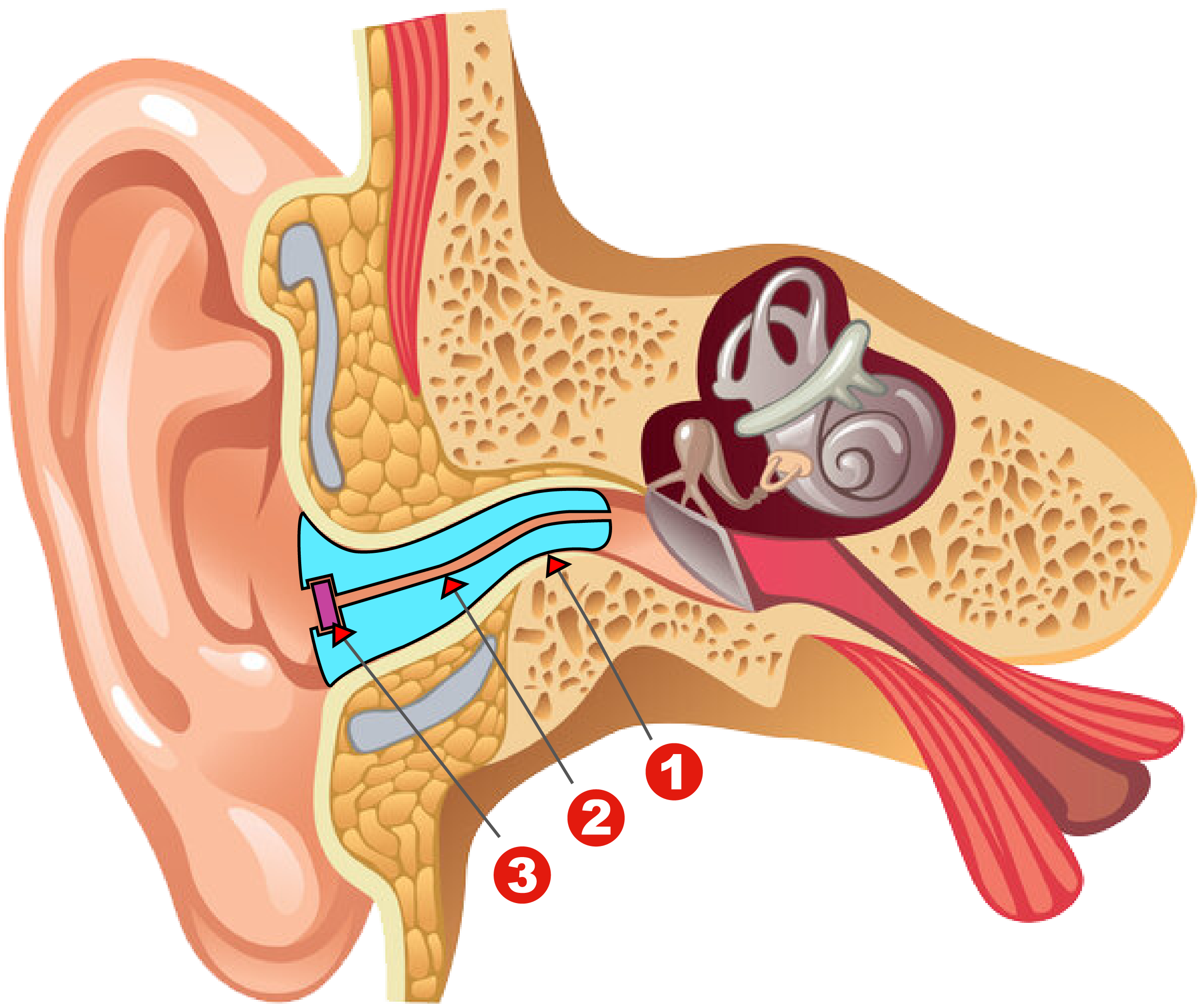 Custom Earplugs Wearing Simulation