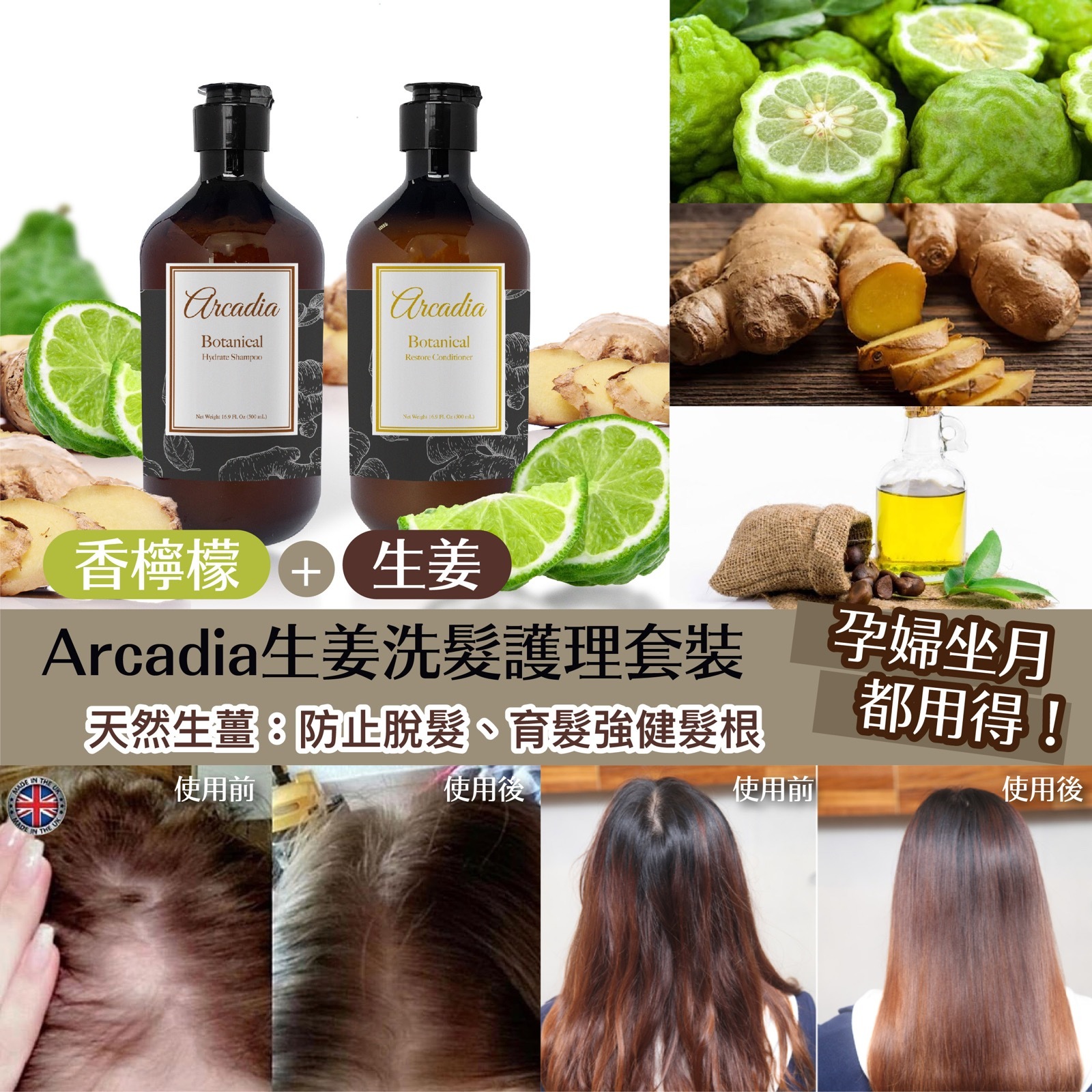 英國Arcadia 生姜洗髮護理套裝