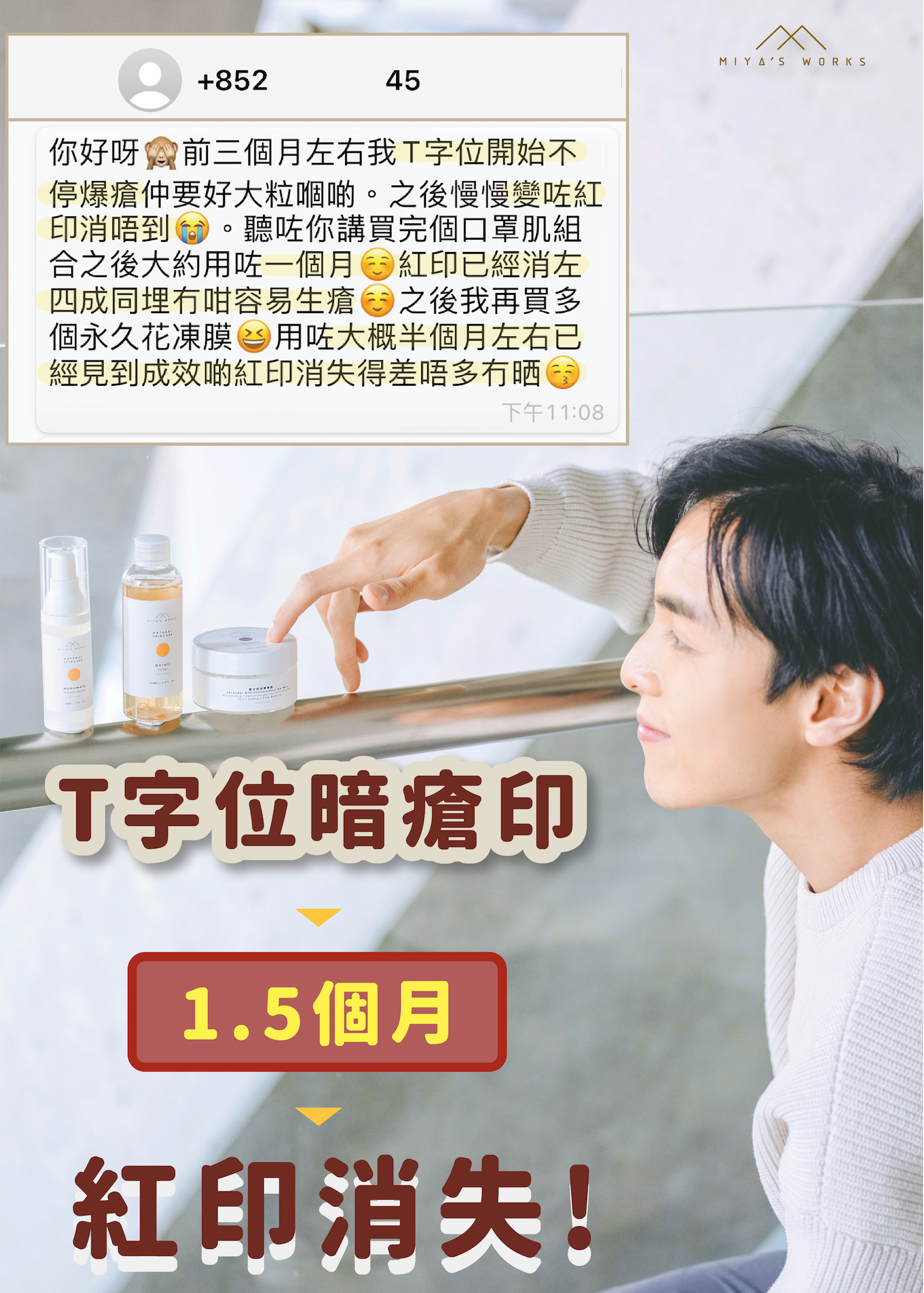 使用永久花凍膜暗瘡印消失