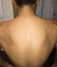 日本消味神皂 黑職柿軽肌皂 告別背痘