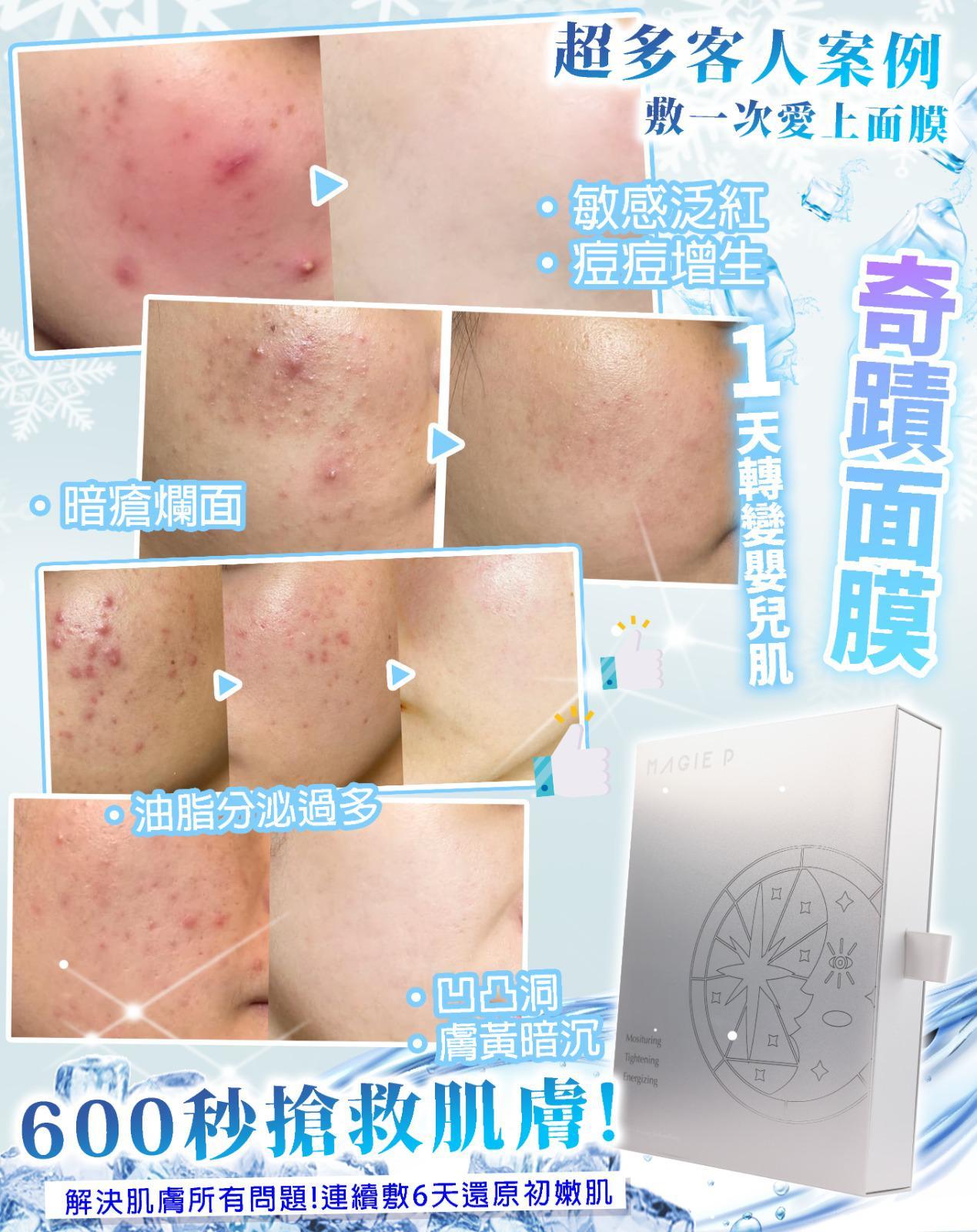 Magic P 奇蹟面膜