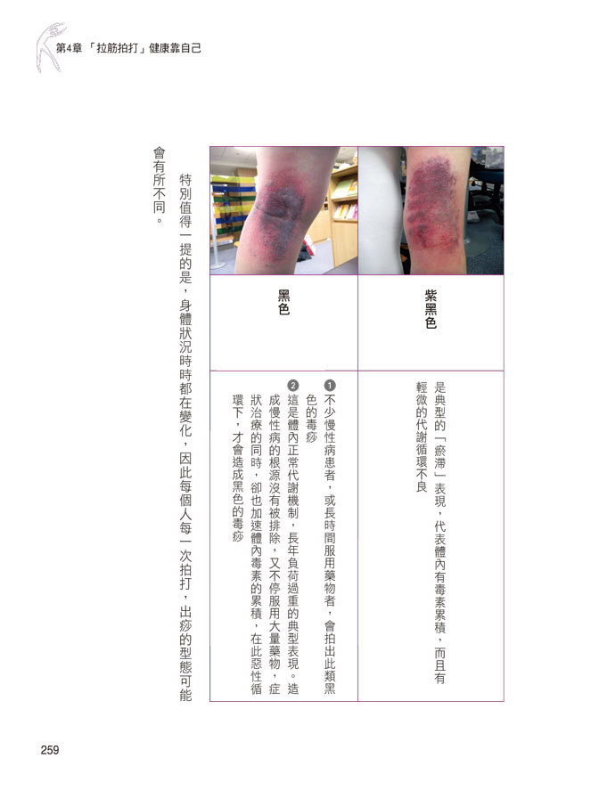 [任選五本$999] 養生學系列 : 拉筋拍打超簡單自療法