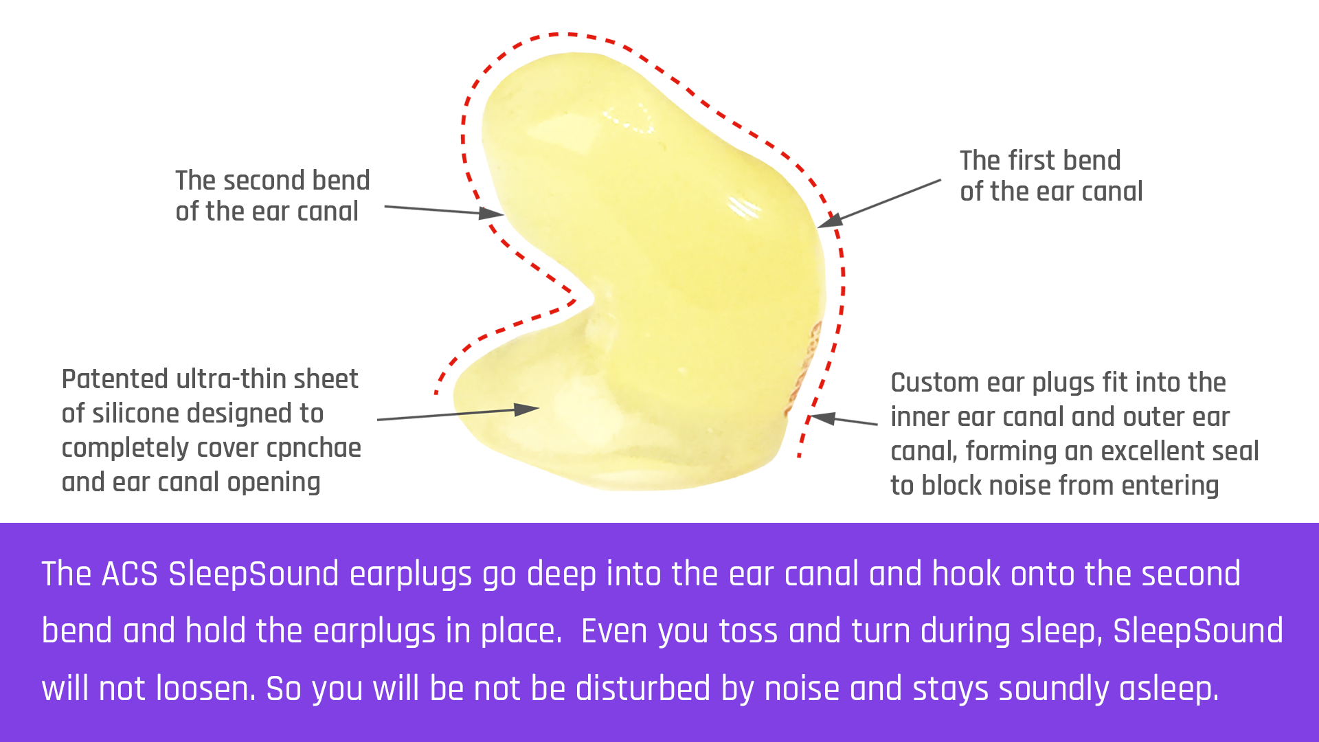The ACS SleepSound earplugs go deep into the ear canal and hook onto the second bend and hold the earplugs in place.