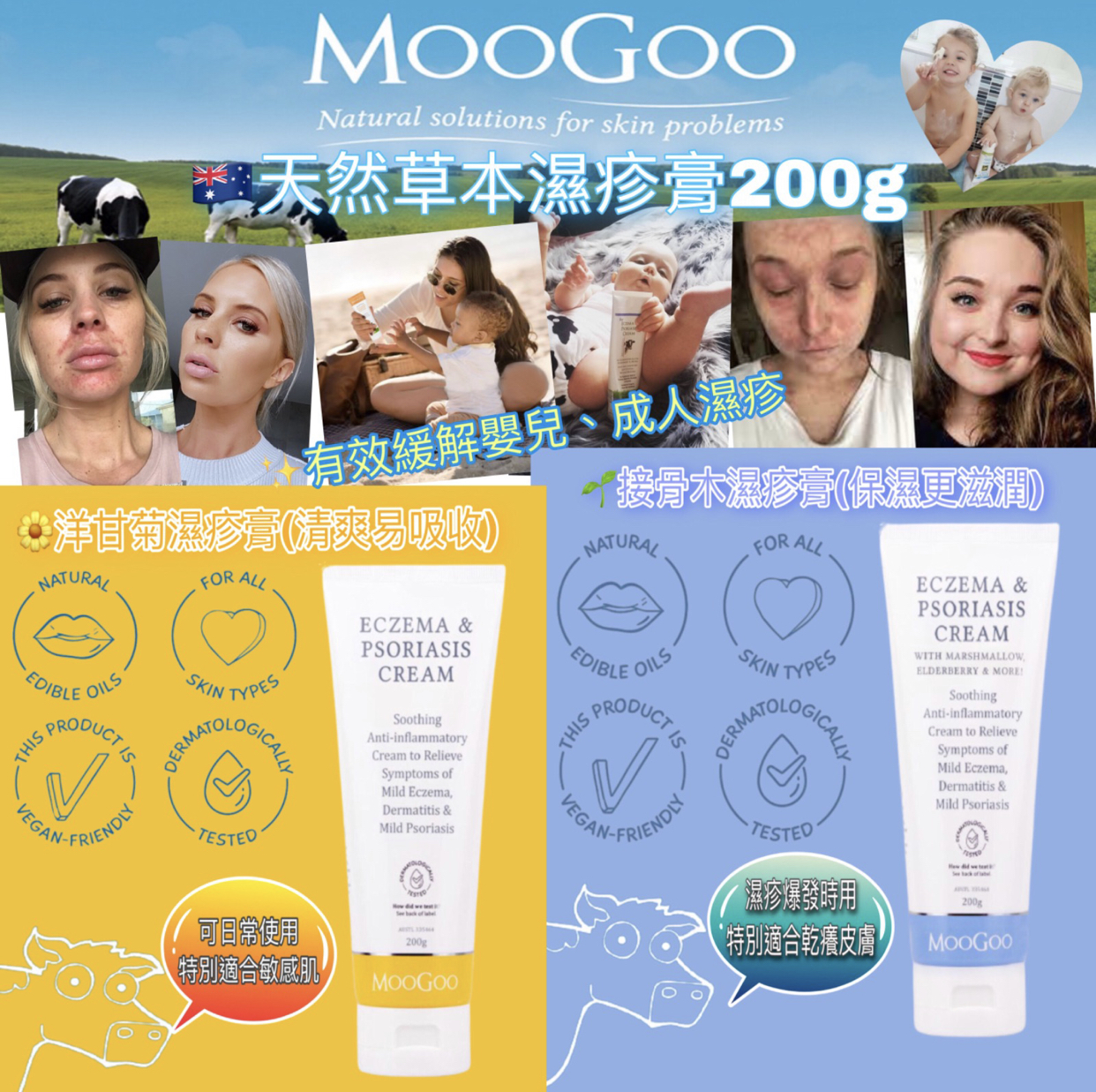 澳洲MooGoo天然草本濕疹膏200g