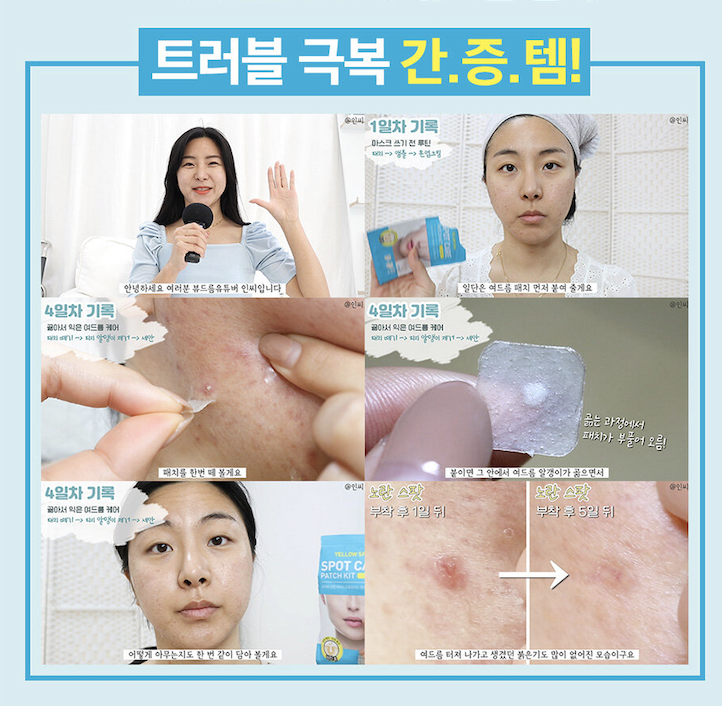 Hatherine Spot Care Patch Kit 暗瘡貼140片裝