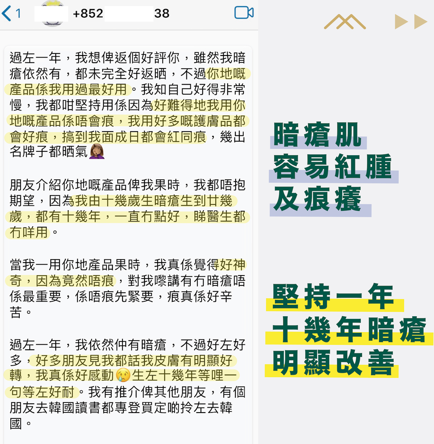 使用去痘去印套裝多年暗瘡明顯改善