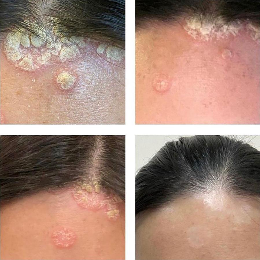 Golden8 Soothing Cream  ｜Golden 8 |  濕疹 ｜傷口救星 | 皮膚炎症 ｜皮膚敏感 ｜牛皮癬｜ 紅疹 ｜皮膚痕癢 ｜痕癢肌 ｜乾燥肌 ｜ 天然成份 ｜中西醫推介 ｜無藥性 ｜不含類固醇 ｜修復濕敏肌 ｜網紅推介