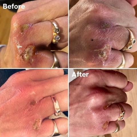 鱷魚油本身與人類皮膚親膚性高，而且含有豐富的Omega-3、6和9、罕有Omega 7 , 及維生素A ， C 和 E； 都是天然抗氧化劑、及皮膚癒合劑，能有效抑菌及抗炎