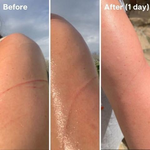 鱷魚油本身與人類皮膚親膚性高，而且含有豐富的Omega-3、6和9、罕有Omega 7 , 及維生素A ， C 和 E； 都是天然抗氧化劑、及皮膚癒合劑，能有效抑菌及抗炎