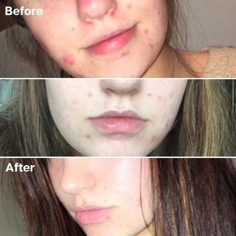 Golden8 Soothing Cream｜Golden 8 |  濕疹 | 皮膚炎症