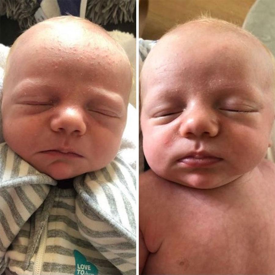 鱷魚油本身與人類皮膚親膚性高，而且含有豐富的Omega-3、6和9、罕有Omega 7 , 及維生素A ， C 和 E； 都是天然抗氧化劑、及皮膚癒合劑，能有效抑菌及抗炎