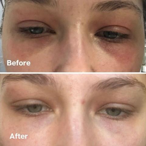 鱷魚油本身與人類皮膚親膚性高，而且含有豐富的Omega-3、6和9、罕有Omega 7 , 及維生素A ， C 和 E； 都是天然抗氧化劑、及皮膚癒合劑，能有效抑菌及抗炎