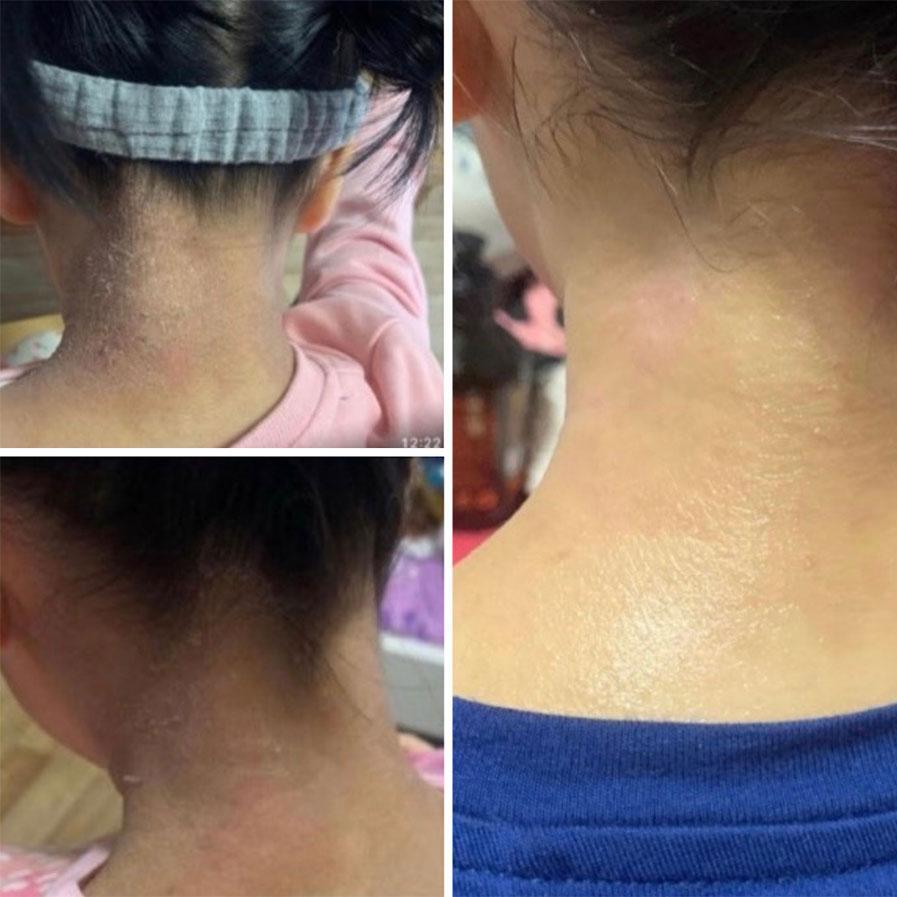 Golden8 Soothing Cream  ｜Golden 8 |  濕疹 ｜傷口救星 | 皮膚炎症 ｜皮膚敏感 ｜牛皮癬｜ 紅疹 ｜皮膚痕癢 ｜痕癢肌 ｜乾燥肌 ｜ 天然成份 ｜中西醫推介 ｜無藥性 ｜不含類固醇 ｜修復濕敏肌 ｜網紅推介