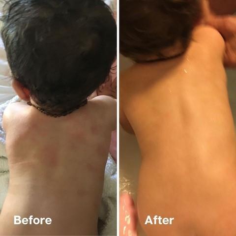 鱷魚油本身與人類皮膚親膚性高，而且含有豐富的Omega-3、6和9、罕有Omega 7 , 及維生素A ， C 和 E； 都是天然抗氧化劑、及皮膚癒合劑，能有效抑菌及抗炎