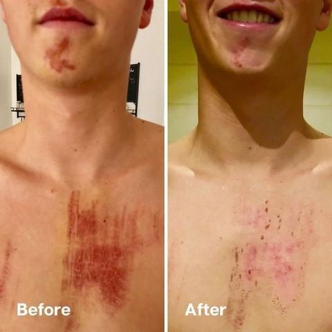 鱷魚油本身與人類皮膚親膚性高，而且含有豐富的Omega-3、6和9、罕有Omega 7 , 及維生素A ， C 和 E； 都是天然抗氧化劑、及皮膚癒合劑，能有效抑菌及抗炎