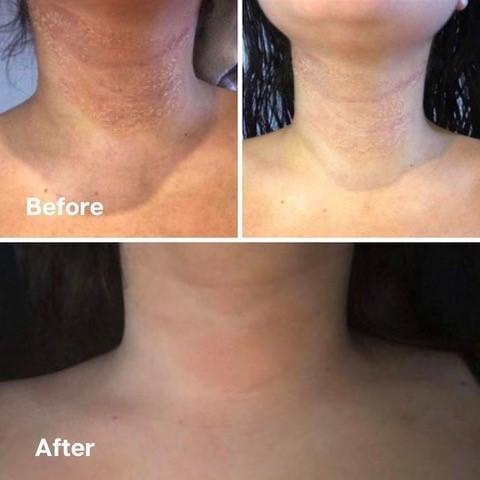 鱷魚油本身與人類皮膚親膚性高，而且含有豐富的Omega-3、6和9、罕有Omega 7 , 及維生素A ， C 和 E； 都是天然抗氧化劑、及皮膚癒合劑，能有效抑菌及抗炎