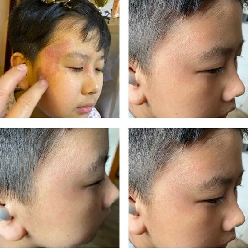 鱷魚油本身與人類皮膚親膚性高，而且含有豐富的Omega-3、6和9、罕有Omega 7 , 及維生素A ， C 和 E； 都是天然抗氧化劑、及皮膚癒合劑，能有效抑菌及抗炎