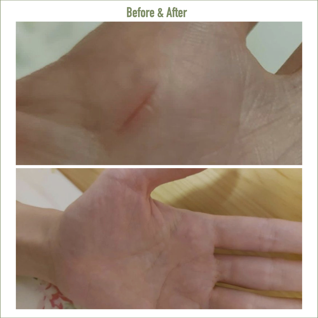 Golden8 Soothing Cream  ｜Golden 8 |  濕疹 ｜傷口救星 | 皮膚炎症 ｜皮膚敏感 ｜牛皮癬｜ 紅疹 ｜皮膚痕癢 ｜痕癢肌 ｜乾燥肌 ｜ 天然成份 ｜中西醫推介 ｜無藥性 ｜不含類固醇 ｜修復濕敏肌 ｜網紅推介