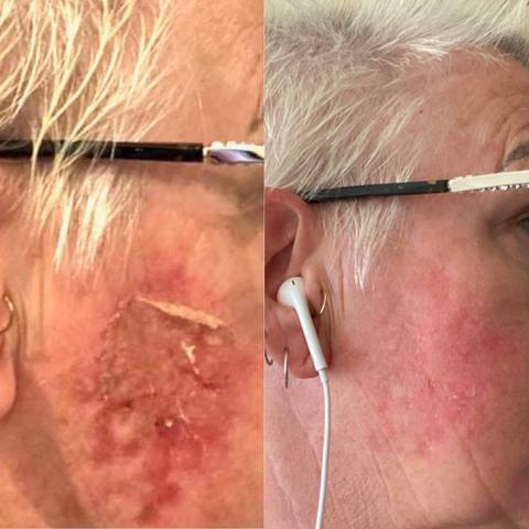 鱷魚油本身與人類皮膚親膚性高，而且含有豐富的Omega-3、6和9、罕有Omega 7 , 及維生素A ， C 和 E； 都是天然抗氧化劑、及皮膚癒合劑，能有效抑菌及抗炎