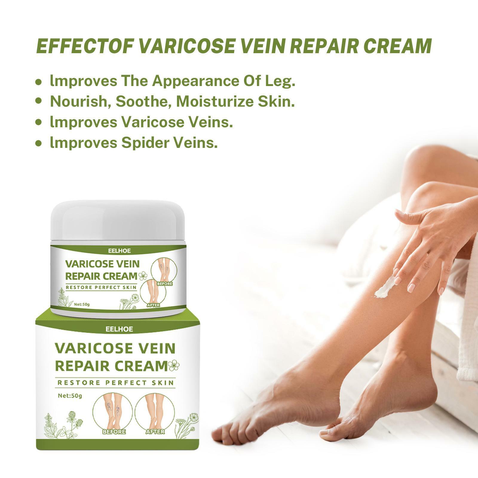 Monkey Home Effective Varicose Vein Repair Cream