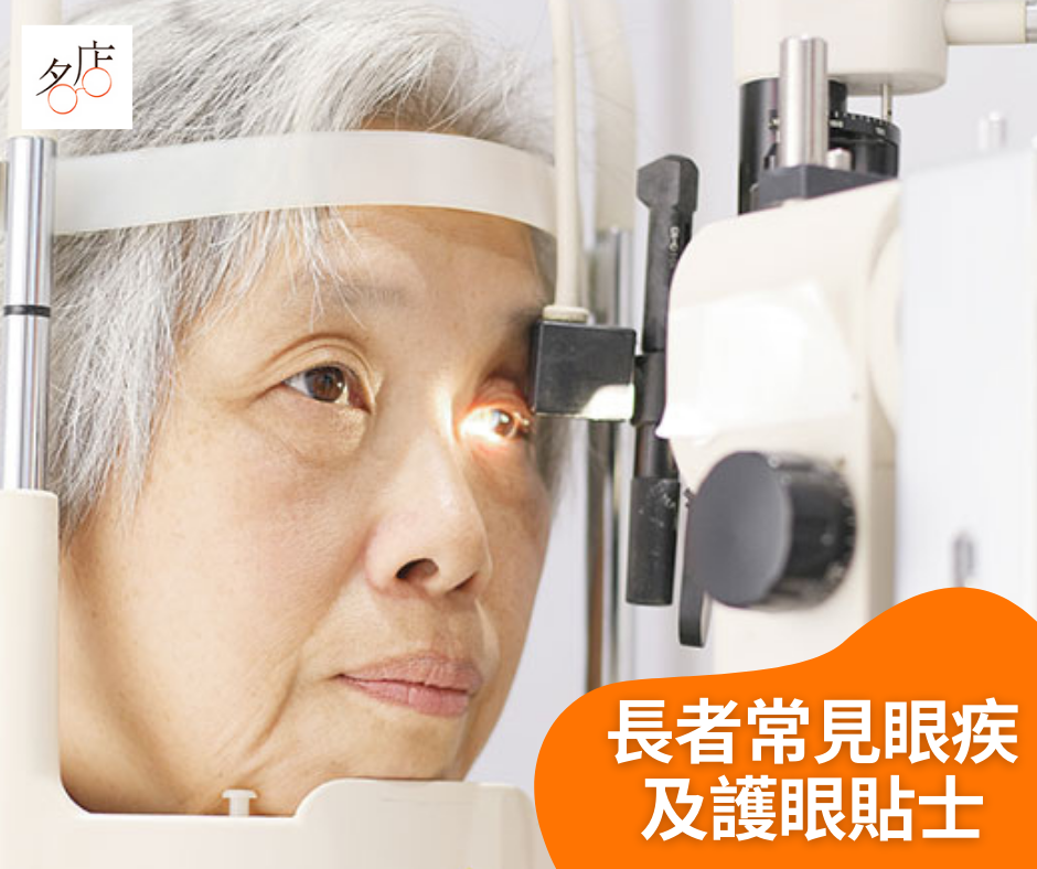 長者常見的5種眼疾及護眼貼士