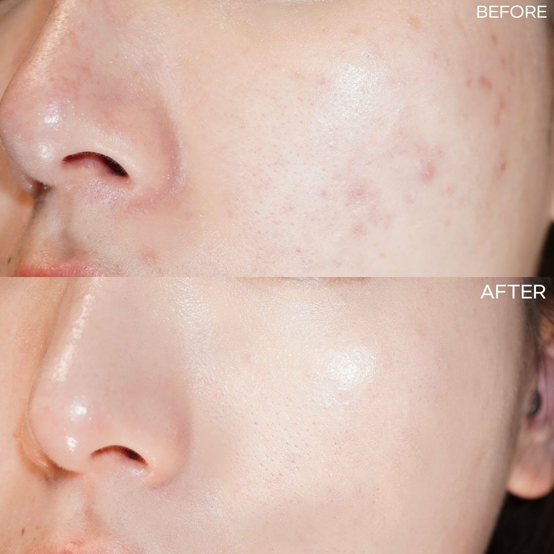 LUNA Conceal Pot 完美持久長效遮瑕膏