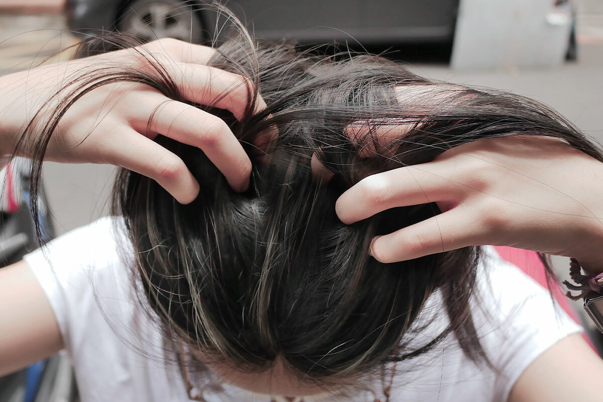 戴安全帽覺得頭皮搔癢