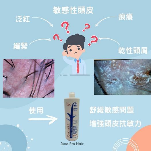 Raywell LOMT 敏感肌膚洗  - 250ml/1000ml