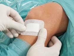 Cosmopor Advance - 配備乾燥隔離®技術的術後傷口敷料