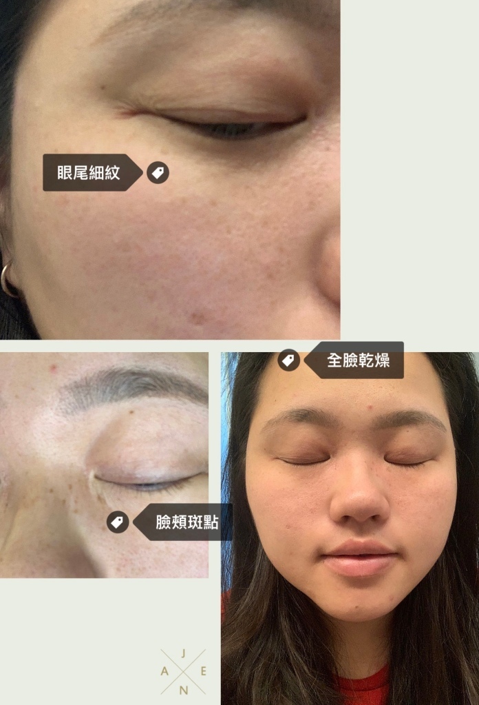 小肥肉欸日常生活推薦Beroso緊緻亮眸逆齡冷暖按摩美顏機