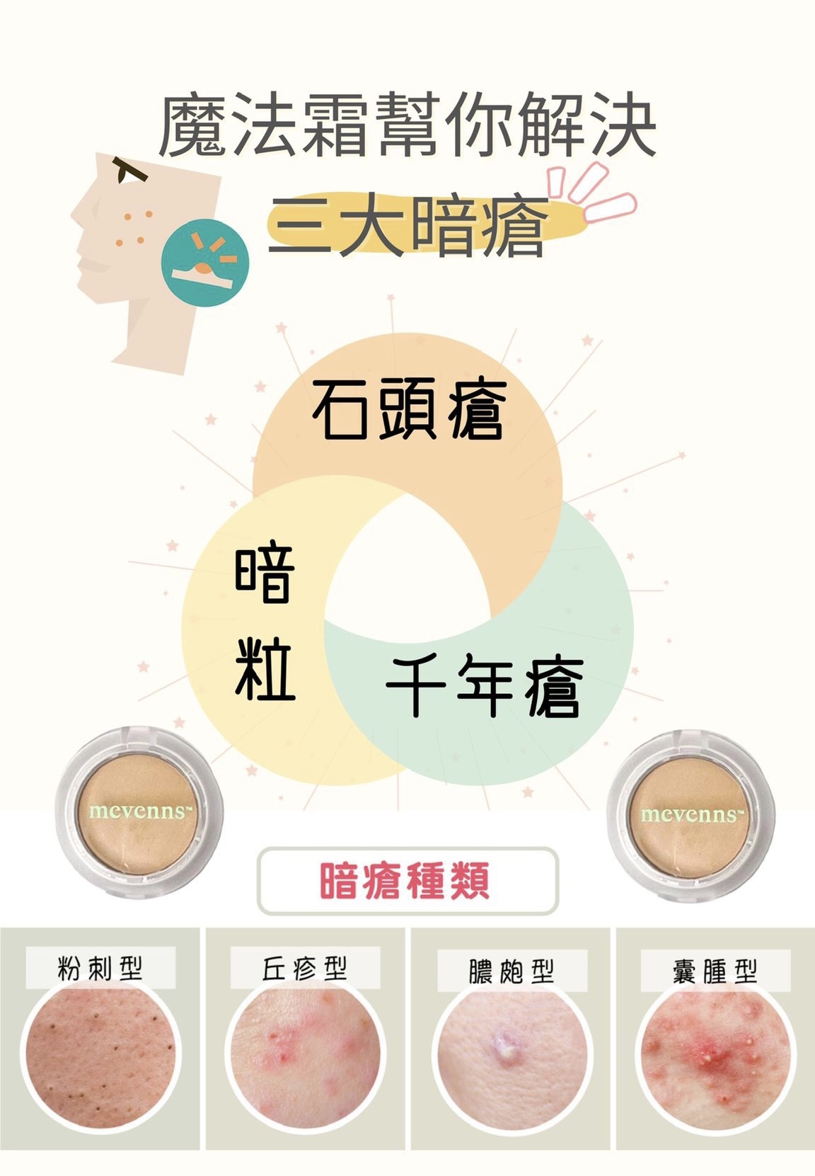 【暗瘡暗粒一瓶K.O.】Mevenns 魔法痘痘霜