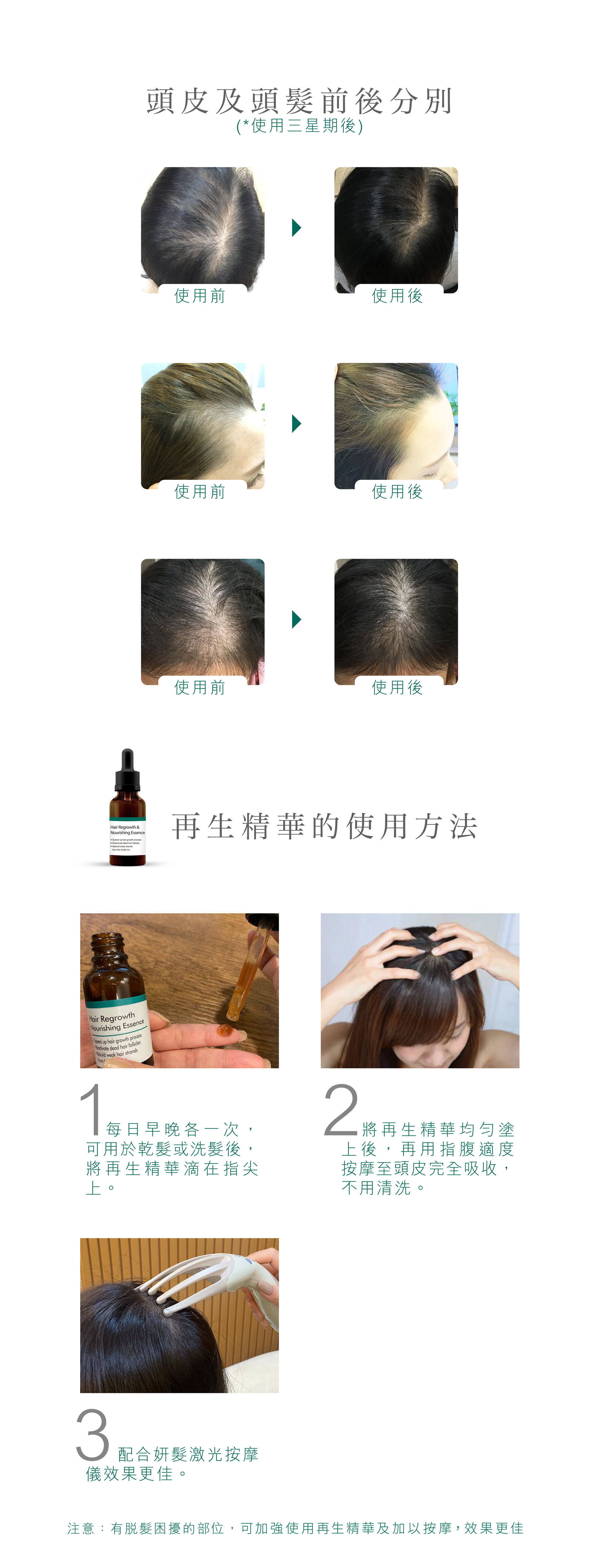 Teris Hair 再生精華