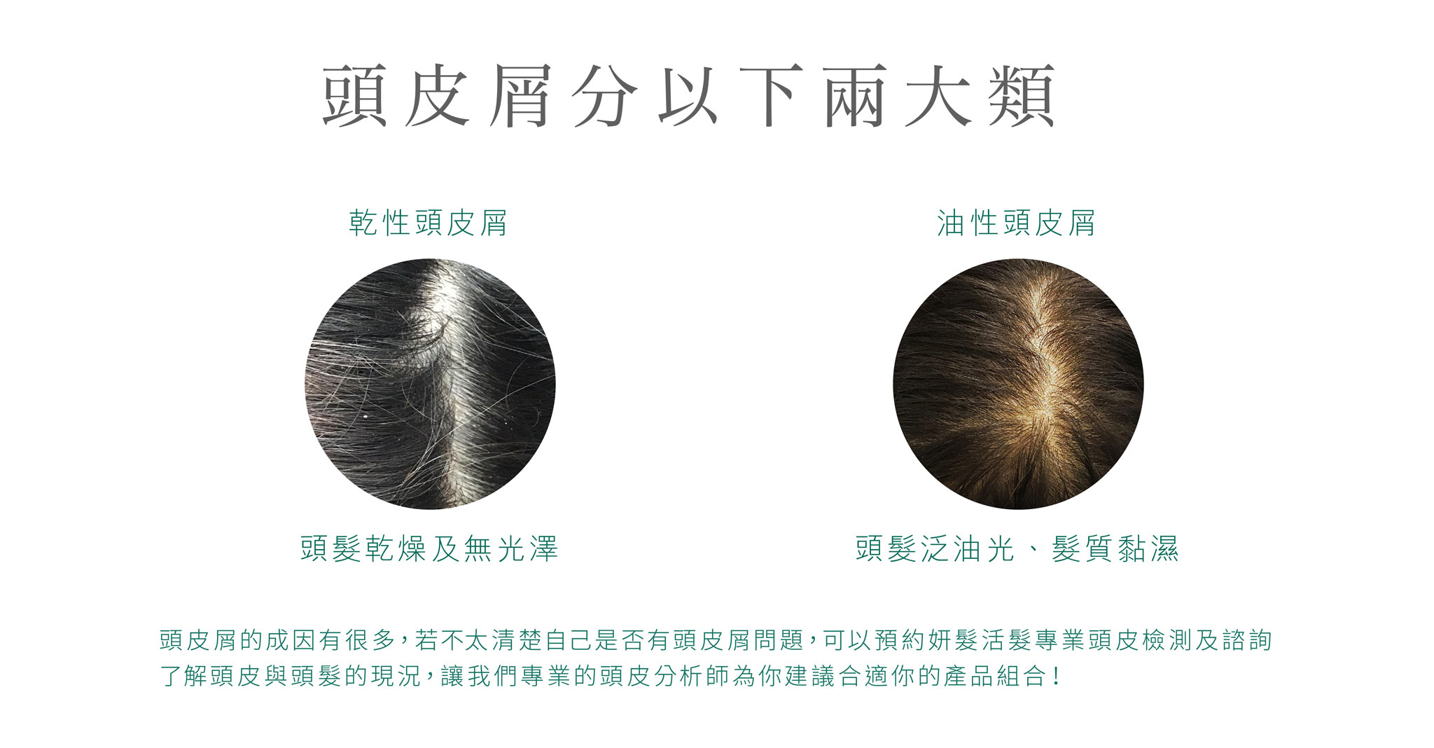 Teris Hair 防脫去屑洗髮水