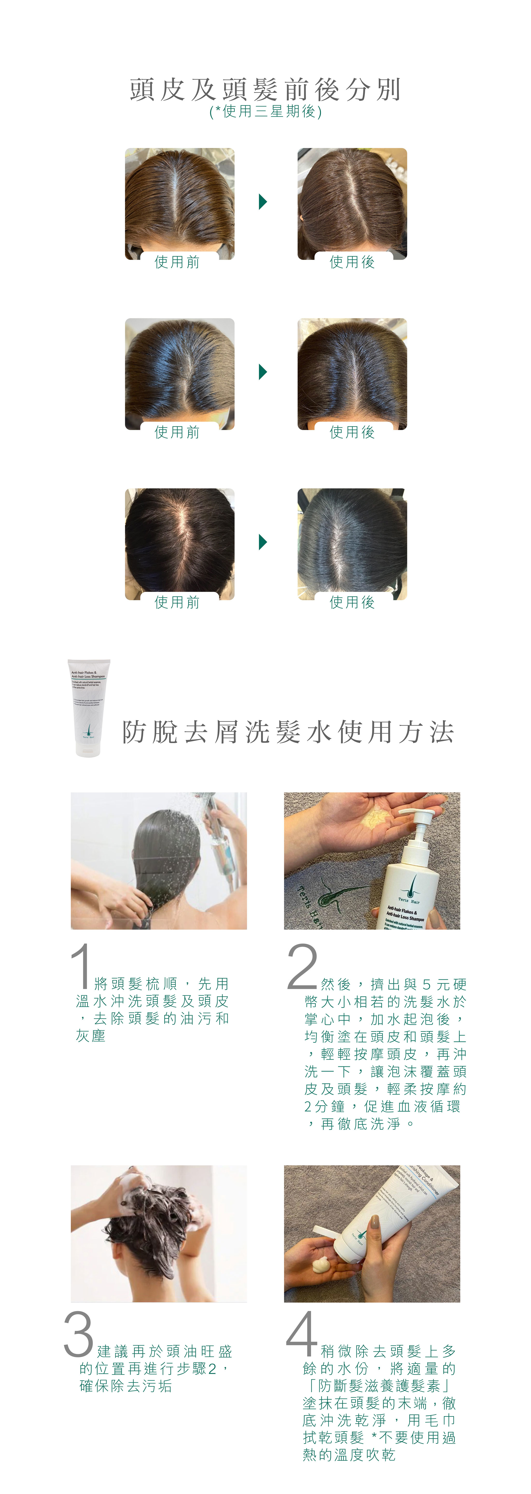 Teris Hair 防脫去屑洗髮水