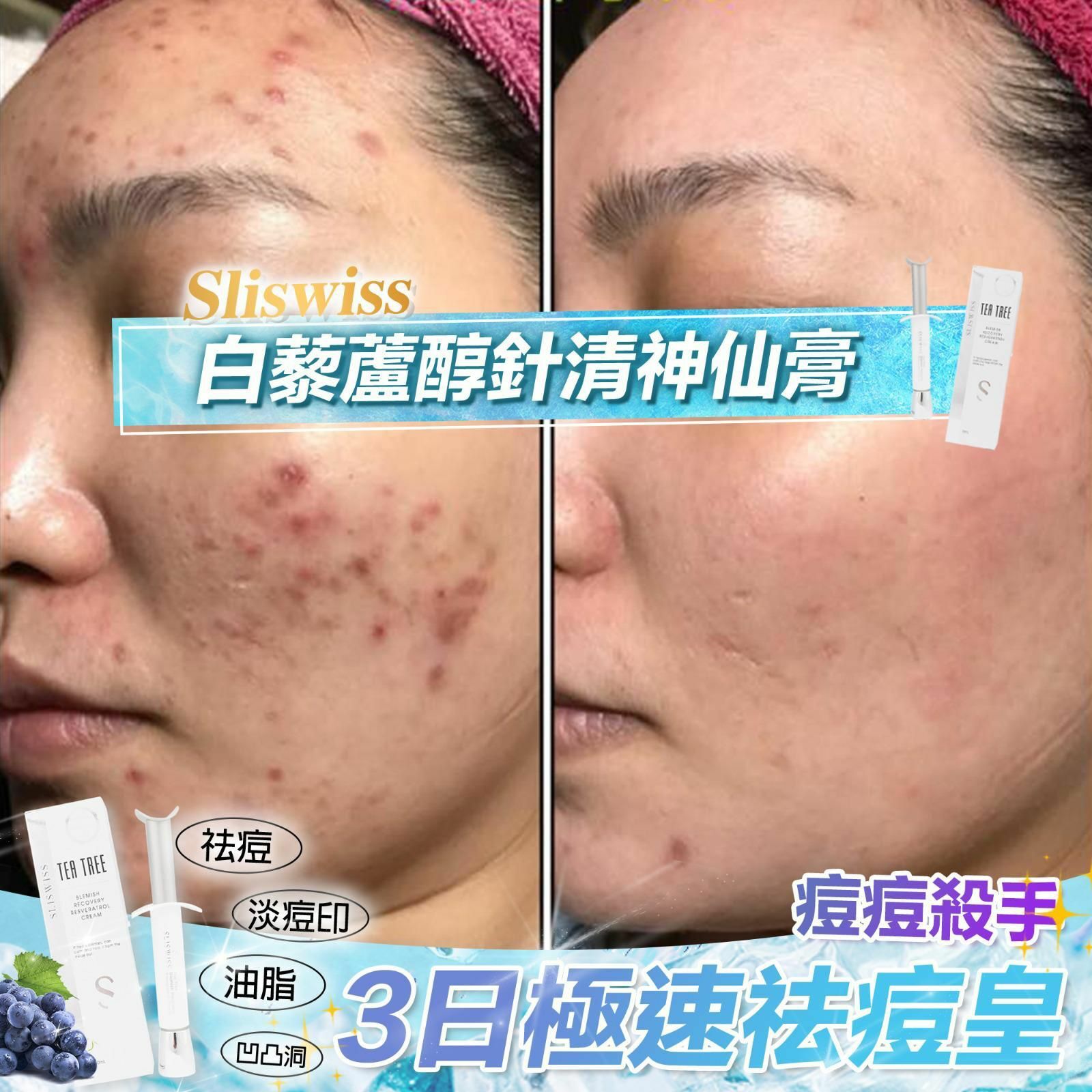 瑞士🇨🇭 SliSwiss針清神仙膏 🧡 ✨SLISWISS 全線買任何2 件 額外再減$20如此類推