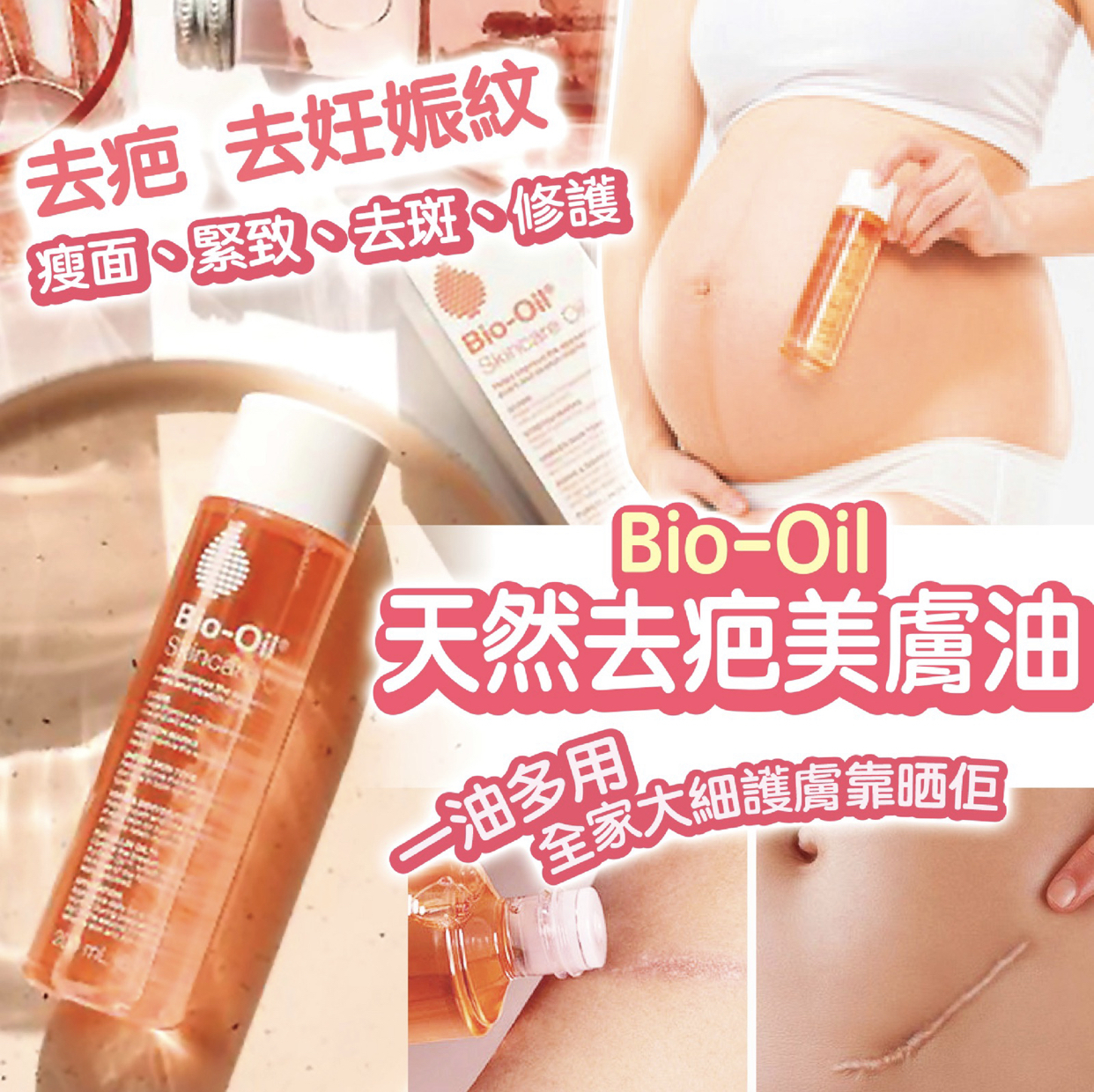 Bio Oil天然去疤美膚油200ml