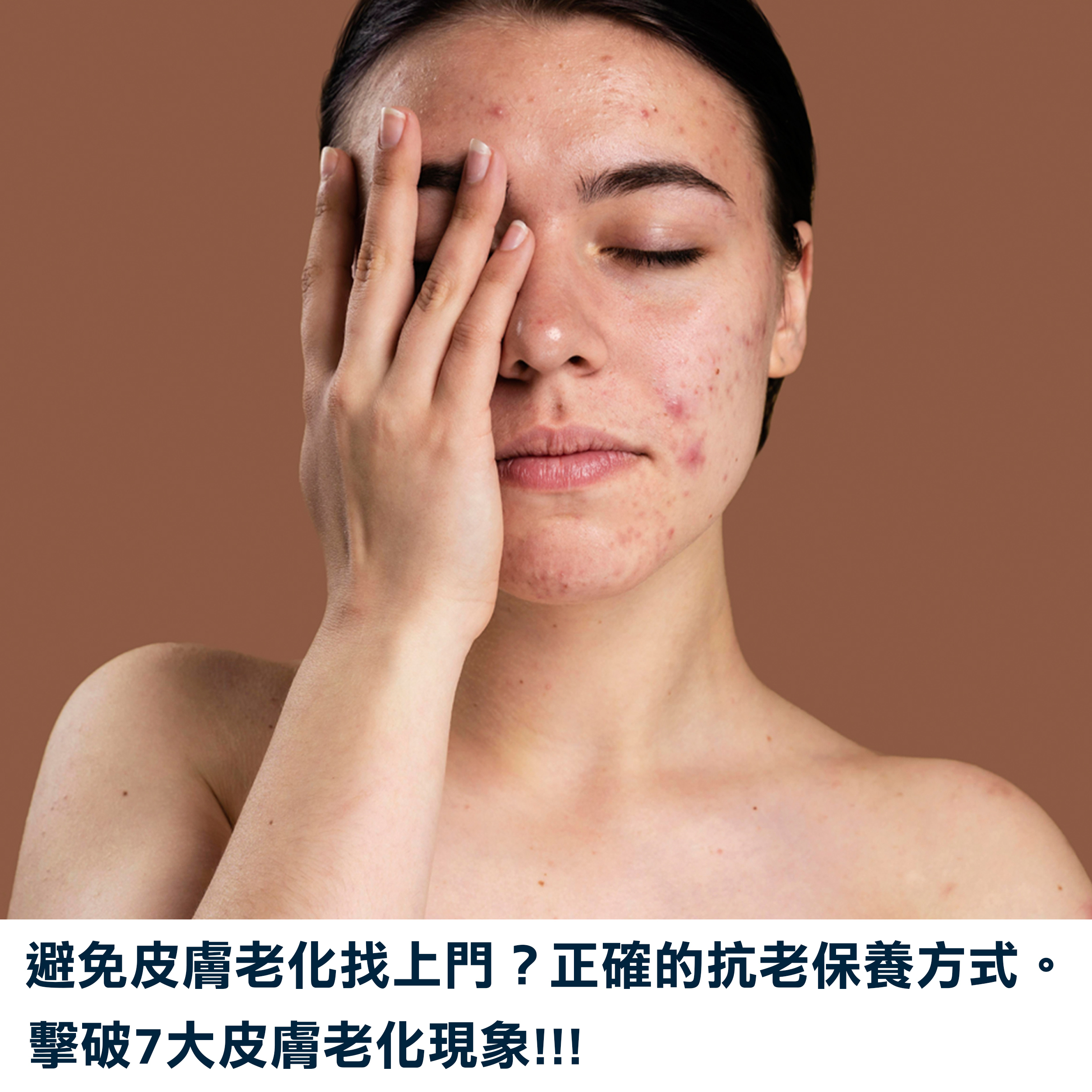 抗老化保養方式,皮膚老化現象