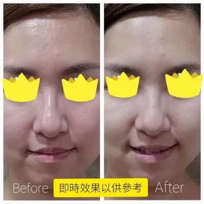 七子白面膜粉 | 香港註冊中醫師認可【Pure Sincere】慈禧太后的美白古方，含白术粉、白芷粉、白芨粉、白芍粉、白蒺藜粉、白蔹粉、白僵蠶、珍珠粉，有助美白肌膚