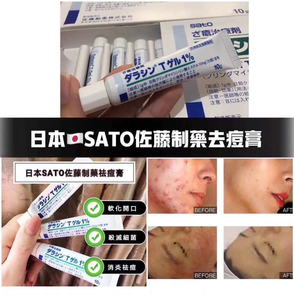 日本Sato佐藤祛痘膏10g