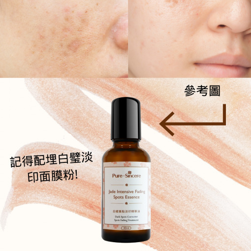 白璧重點淡印精華油【Pure Sincere】內含多種草本精華，促進肌膚的新陳代謝﹑活血化瘀﹑淡化疤痕及提升肌膚光澤。建議同時配合白璧淡印面膜粉,效果更佳