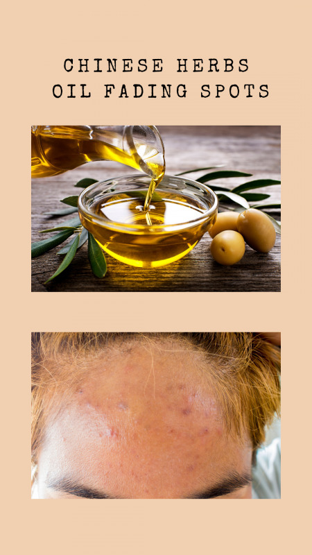 白璧重點淡印精華油【Pure Sincere】內含多種草本精華，促進肌膚的新陳代謝﹑活血化瘀﹑淡化疤痕及提升肌膚光澤。建議同時配合白璧淡印面膜粉,效果更佳