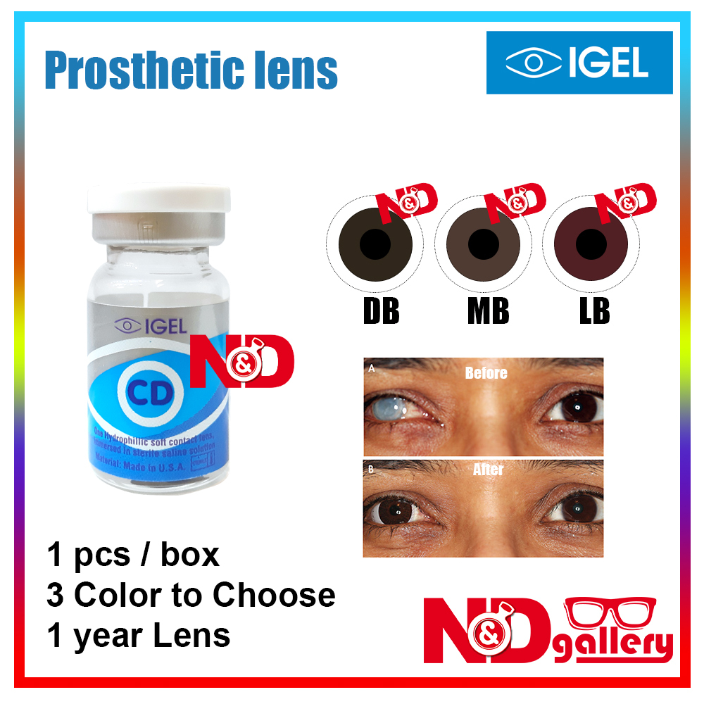 Igel CD 38 Prosthetic Iris Color lens  14mm 1 Year Disposable 1pc/Vial  Ready stock