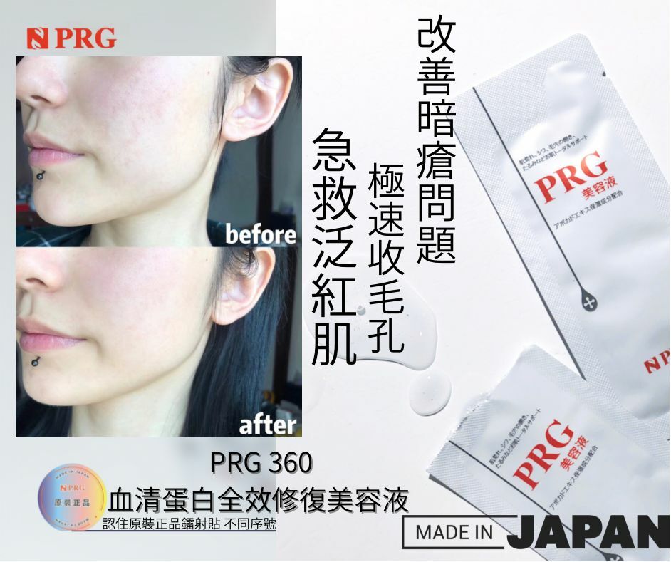 💥日本PRG360 血清蛋白全效修復美容液💥獨立包裝一盒90片
