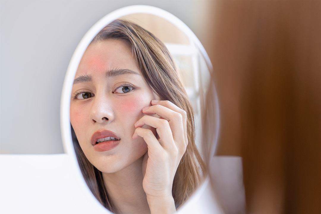 敏感肌,保養,敏感,泛紅