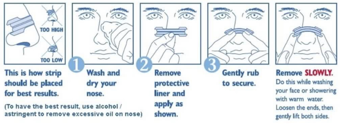 通氣止鼻鼾鼻塞膠布