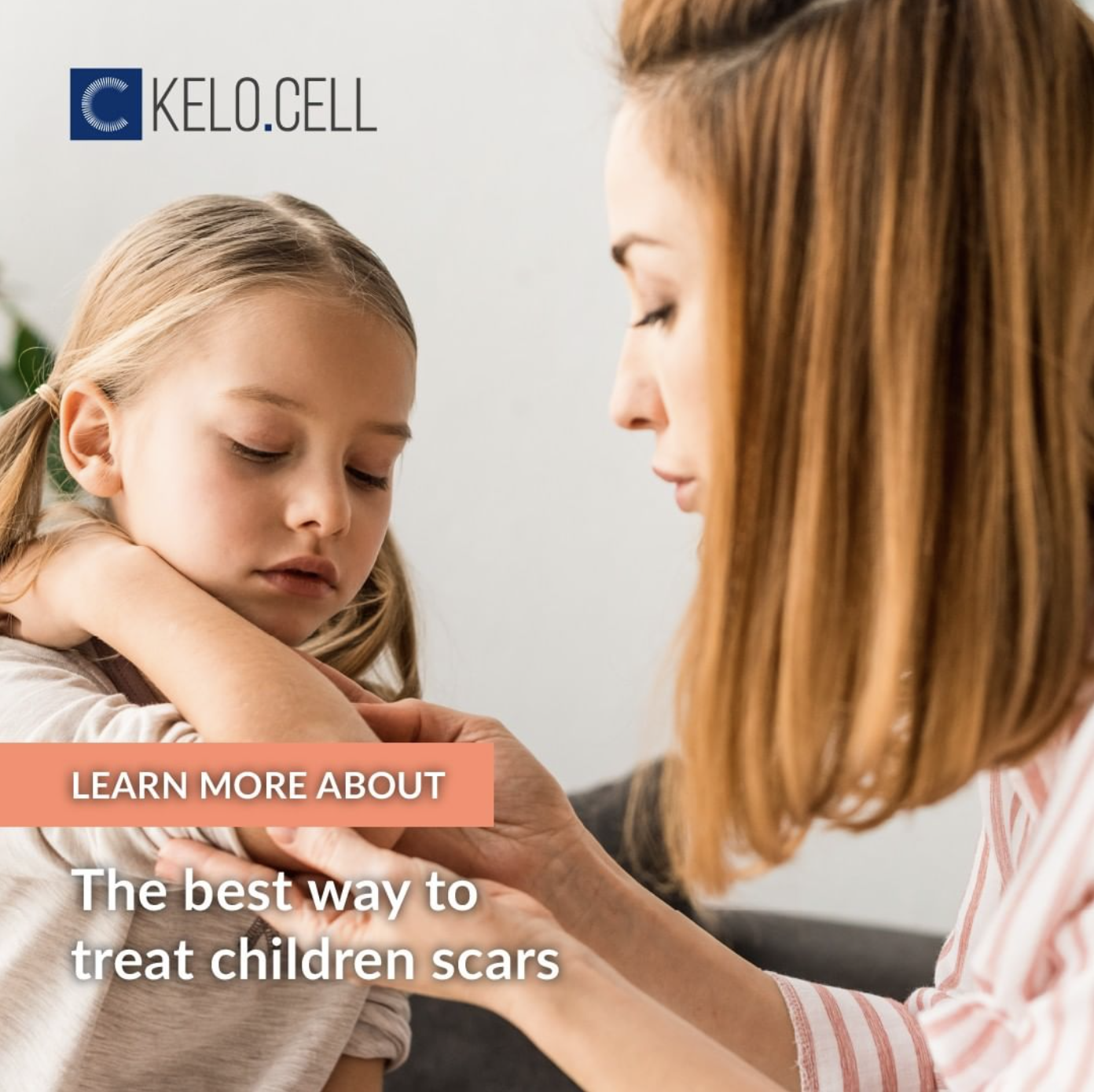 Kelo Cell Biogel The best way to treat children scars