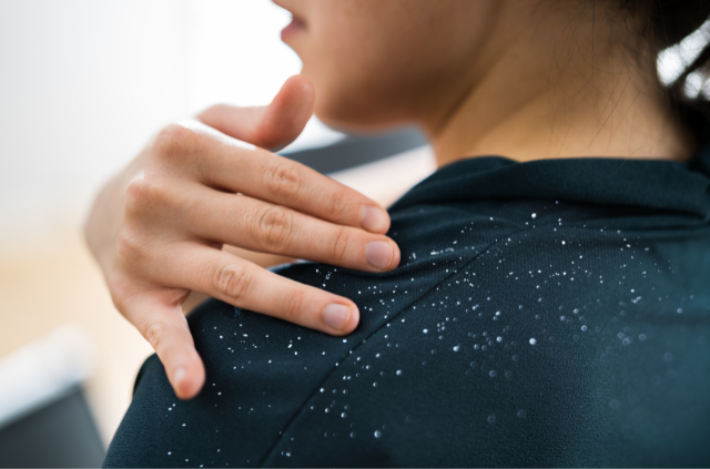 手掃掉肩上的頭皮屑