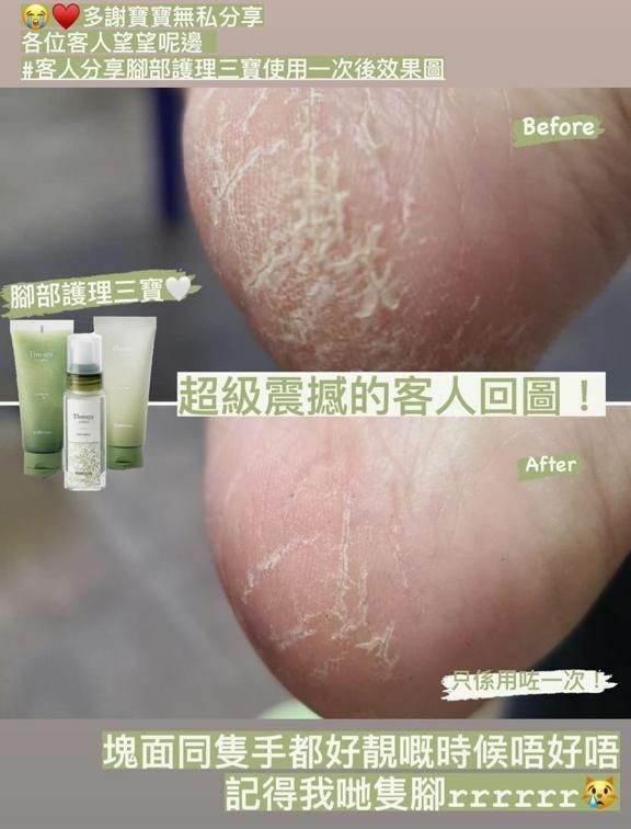 手腳護理 jumbo 套裝