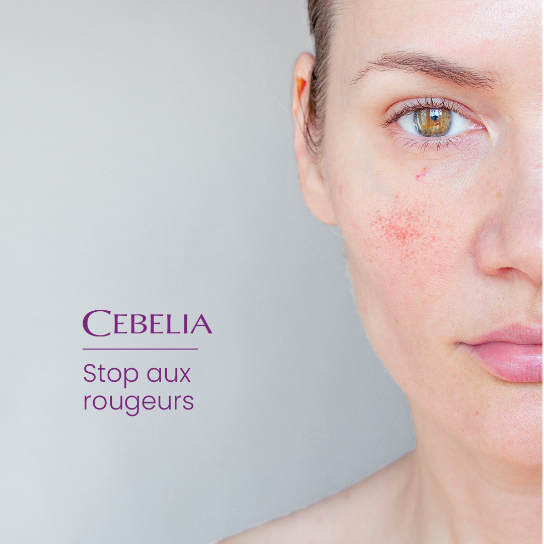 酒糟肌保養-絲寶麗寡胜肽系列推薦