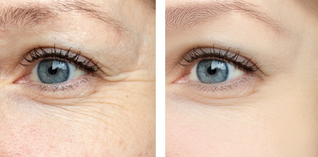 熟齡肌保養方法大公開,熟齡保養品挑選要點